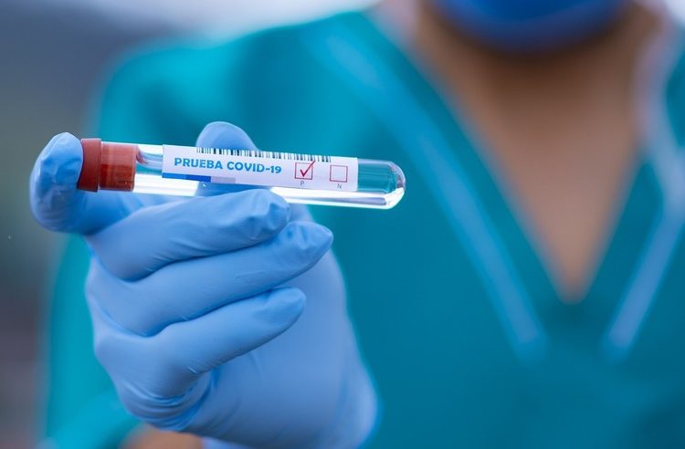 В перший день тижня на Сокальщині – 6 нових випадків коронавірусу